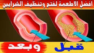19 نوع من الاطعمة لتنظيف الشرايين من الكوليسترول والدهون وتمنع انسدادها