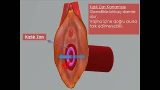 #qizlik #qizlikpardasi #bokiralik #qizliknitiklash #gimenoplastika  #qizlikkapsulasi  Qizlik pardasi