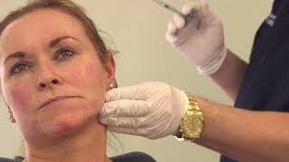 Full face filler treatment - non-surgical volumetric facelift