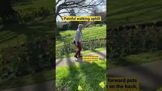 Painful Walking Uphill with Hypermobility