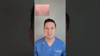 Dermatologist Explains Stretch Marks: What causes them & how to treat at home! #stretchmarks