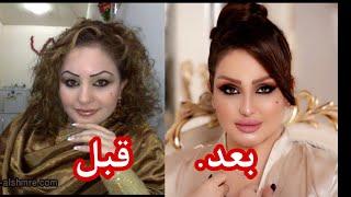 شهد الشمري قبل وبعد التجميل صدمة كبيرة