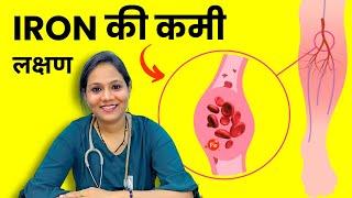 Symptoms of Iron Deficiency in Hindi | शरीर में लोह की कमी के लक्षण