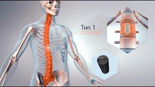 Эксплейнер: видеореклама производство имплантов. Explainer - презентация нового продукта.