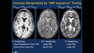 MRI Basics Part 1