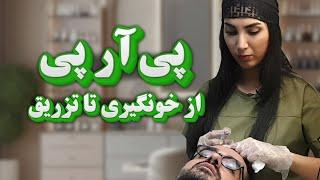 تزریق پی ار پی موی سر - درمان ریزش مو | PRP