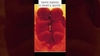 #twinsbabies #shortsfeed #babyinwomb