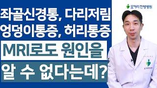 좌골신경통, 엉덩이통증, 다리저림 MRI로도 알 수 없는 원인, 뭐가 문제인가?