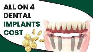 All On 4 Dental Implants Cost