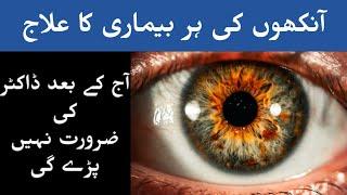 Aankhon ki Roshni tez krne ka Wazifa #Allah # Wazifa