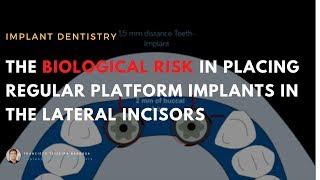 Implant placement in the aesthetic zone. Biological Considerations.