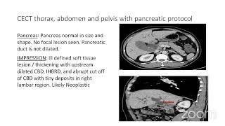 PG CLINICS OBSTRUCTIVE JAUNDICE