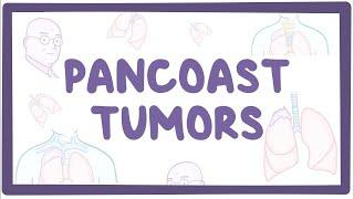 Pancoast tumors - causes, symptoms, diagnosis, treatment, pathology