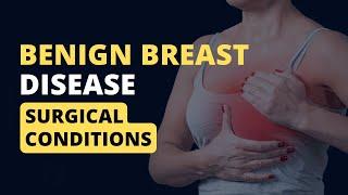 #Benign #Breast Disease That Every Woman Should Know About | #surgicalconditions #surgerysimplified