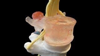Academic LxH anatomical spine model by Dynamic Disc Designs Corp.