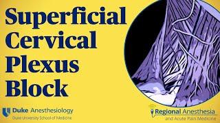 Superficial cervical plexus block