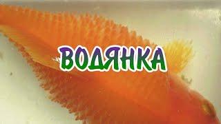 ВОДЯНКА. СИМПТОМЫ И ЛЕЧЕНИЕ