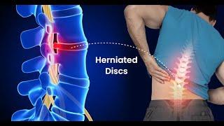 Total Spine and Vertebrae Regeneration , Fix Herniated Discs  (Advanced Morphic Field)