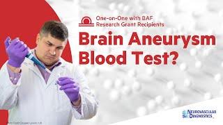 Diagnosing unruptured brain aneurysms with a blood test - Vincent Tutino explains | BAF