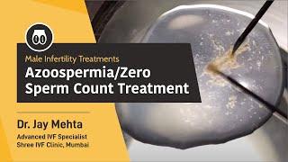 Azoospermia/Zero Sperm Count Treatment | TEFNA | Male Infertility Treatment | Dr Jay Mehta, Mumbai