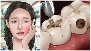 [ASMR] My teeth hurt so much! cavities treatment animation