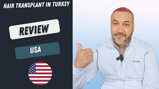 Hair Transplant in Turkey Review l Worbimed Clinic