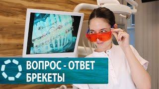 Вопрос - ответ с ортодонтом: всё что вы хотели знать о брекетах!