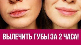  Как быстро восстановить губы? Экспресс вариант за 2 часа! 