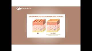 Вебинар сочетанные методики БлюмГель