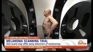 VECTRA WB360® featured on 7 Network’s Sunrise Morning Show