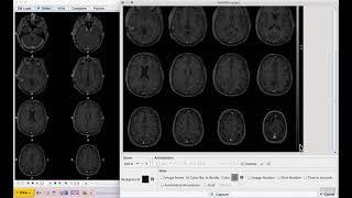 H1E4 Image display and capture