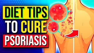 Diet Food Tips For Treating and Reducing Psoriasis