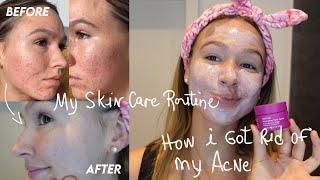 my holy grail skincare routine & how I healed my acne