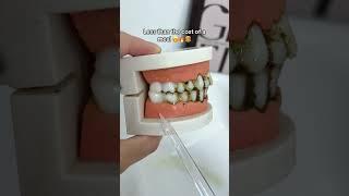 Transform Your Oral Hygiene Routine with This Water Flosser