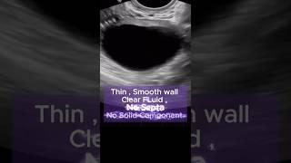 41mm Simple Ovarian Cyst - Ultrasound | What to do?