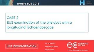 Livedemo | Nordic EUS 2018 | EUS examination of the bile duct with a longitudinal Echoendoscope