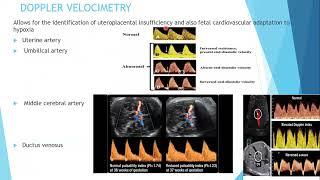 FGR Screening & Management Protocol - Dr L Hlatywayo