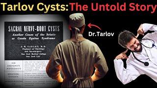 The Untold Story of Dr. Isadore Tarlov: Symptomatic Tarlov Cysts