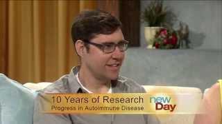 Progress in Autoimmune Disease Research and Living with Five Autoimmune Diseases