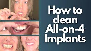 How to clean All-on-4 Implants