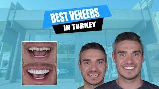 You won't believe your image in the mirror! | Premium Veneers   | Myra Dental Centre #veneers