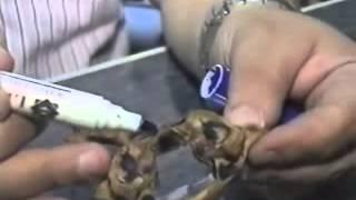 MNF Medad Team | Dr. Ayman Abdallah H&N Practical Anatomy [ Bone 02 ]