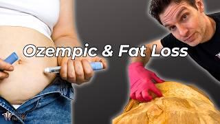 What Ozempic & Weight Loss Drugs Really Do to the Body