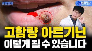 아르기닌 입술 헤르페스 부작용 이걸 드시면 깔끔하게 해결됩니다(아르기닌 부작용에 대한 진실과 라이신의 효능)