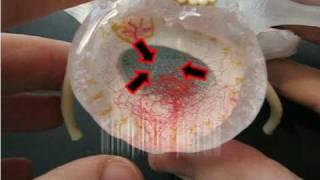 Realistic Lumbar Disc Model by Dynamic Disc Designs Corp.