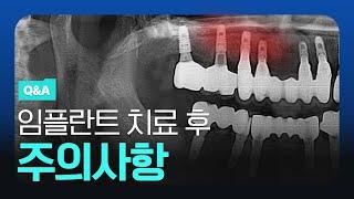 01.임플란트 완성 후 수리