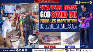 WATCH HOW GOD SAVED ME FROM LEG AMPUTATION IN ELOHIM MINISTRY