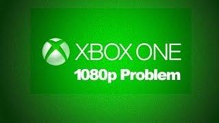 Xbox One 1080p Problem | Beispiele & Gründe für das Technik-Problem