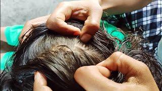 Routine Nitpicking / Lice Picking By My Mom Hands With Real Sounds For Oiled Hair's