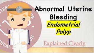 Abnormal Uterine Bleeding Series - Endometrial Polyp